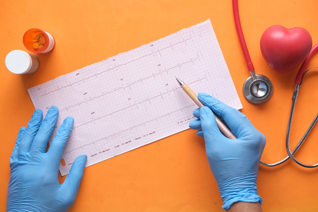 Atrial Fibrillation vs Ventricular fibrillation: Know the difference to save lives