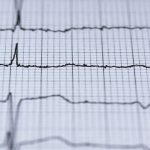 Heart Attack & Slow Heart Rate-When is it Dangerous?