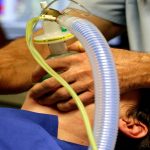 Why do you need a ventilator after a heart attack?