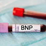 Can BNP be elevated without heart failure?